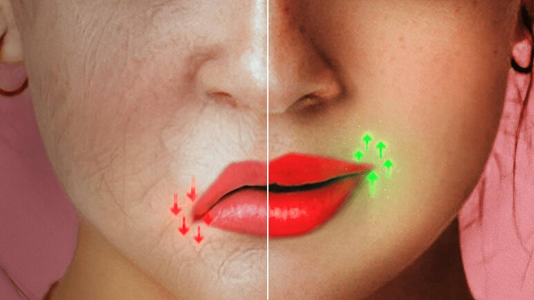 How to Fix old age frowning smile (from a plastic surgeon)